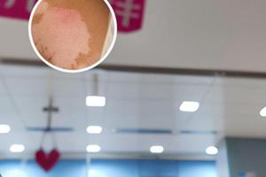 半島308光療儀怎么樣好用嗎